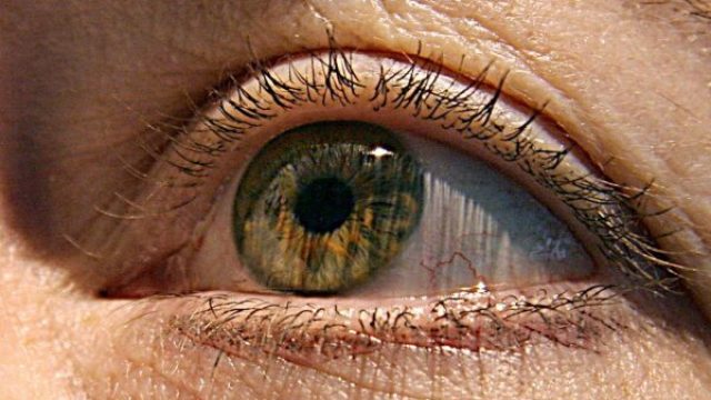 New Drug Approval Shakes Up Thyroid Eye Disease Treatment Landscape